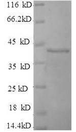 Human SEPP1 protein