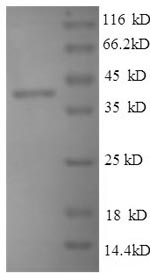 Mouse Thbs1 protein
