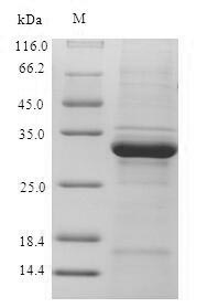 Human UBE2D3 protein