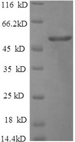 Recombinant Salmonella typhimurium Outer membrane porin protein OmpD (ompD)