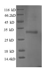Human UBE2W protein