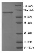 Human NAGK protein