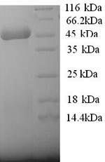 Human ACAA2 protein