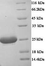 Mouse C1qa protein