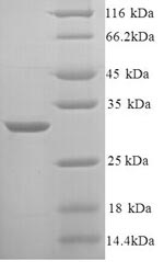 Yeast Kng1 protein