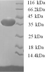 Mouse Osteopontin protein