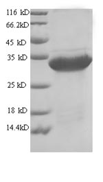 Yeast Uricase protein