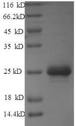 Recombinant Rabies virus Matrix protein (M)