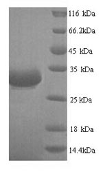 Yeast T7 Helix-destabilizing protein