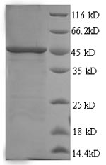 Human SMARCB1 protein
