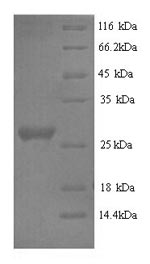Rabbit IL6 protein