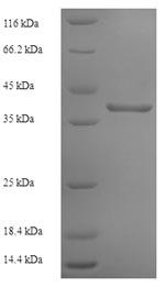 Human IFNAR2 protein
