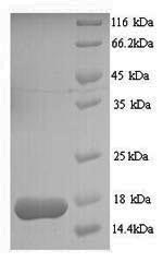 Yeast MDR1 protein