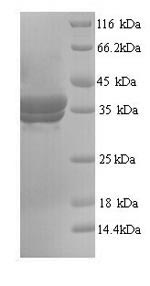 Yeast Annexin A5 protein