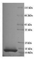 Yeast IL15 protein
