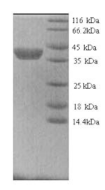 Yeast MMP9 protein