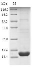 Recombinant Human Sodium-dependent phosphate transport protein 2B (SLC34A2), partial
