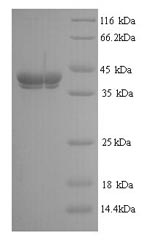 Yeast Pectate lyase 1 protein