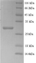 Yeast LCR83 protein
