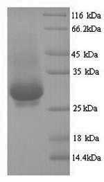 Yeast VP4 protein