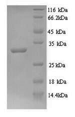 Yeast lepB protein