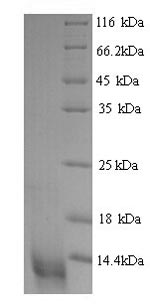 Yeast CCL20 protein