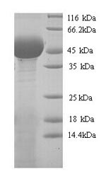 Yeast Pectate lyase 1 protein