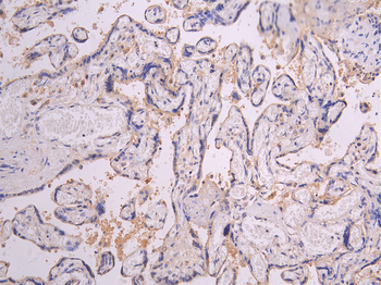 PRLR Antibody