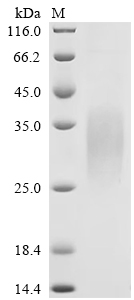 Recombinant Mouse Glucagon-like peptide 1 receptor (Glp1r), partial (Active)