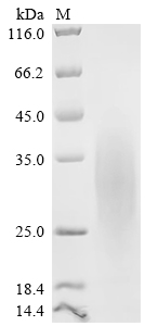 Recombinant Rat Glucagon-like peptide 1 receptor (Glp1r), partial (Active)