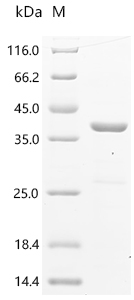 Recombinant Human Vacuolar protein sorting-associated protein 29 (VPS29), partial