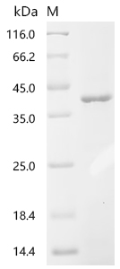 Recombinant Influenza B virus Nucleoprotein (NP), partial