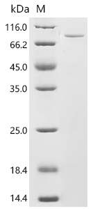 Recombinant Human Peroxisomal multifunctional enzyme type 2 (HSD17B4)