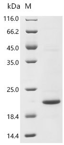 Recombinant Human C-C motif chemokine 5 (CCL5)