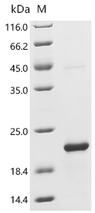 Recombinant Human C-C motif chemokine 5 (CCL5)