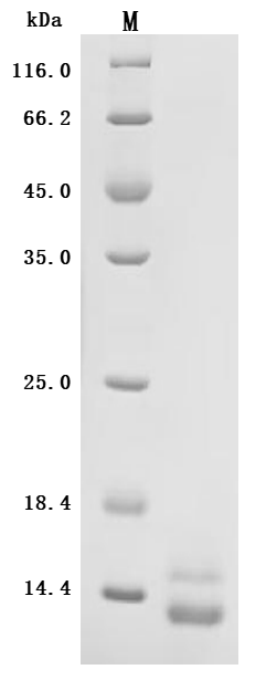 Recombinant Human Inositol 1,4,5-trisphosphate receptor-interacting protein-like 1 (ITPRIPL1), partial (Active)