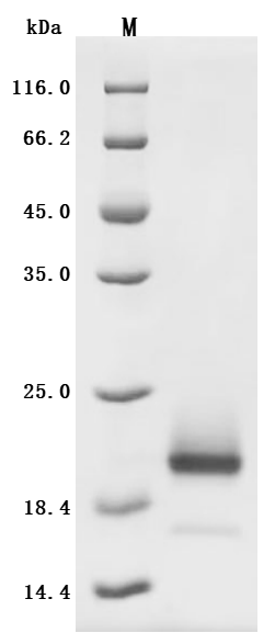 Recombinant Human Interleukin-4 (IL4) (Active)