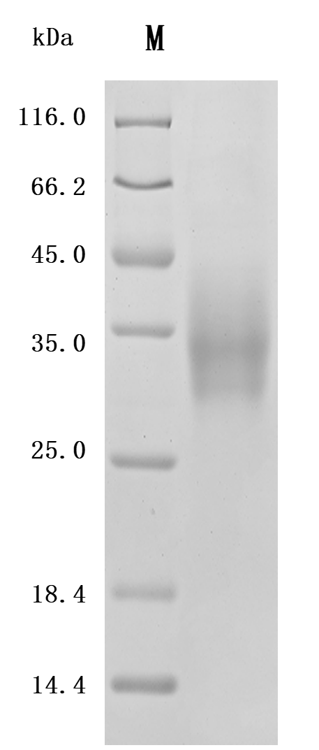 Recombinant Human Leukocyte surface antigen CD47 (CD47), partial (Active)