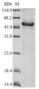 Recombinant Human Hyaluronidase PH-20 (SPAM1)