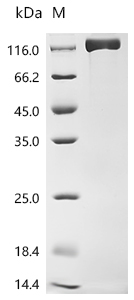 Recombinant Human Ectonucleotide pyrophosphatase/phosphodiesterase family member 3 (ENPP3), partial (Active)