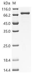 Recombinant Human Coagulation factor XI (F11) (Active)