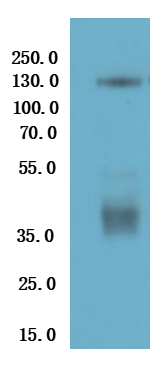 Recombinant Human Thyrotropin receptor (TSHR)-VLPs (Active)