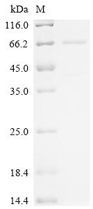 Recombinant Mouse Putative phospholipase B-like 2 (Plbd2)