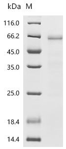 Recombinant Human Ubiquitin-like modifier-activating enzyme 6(UBA6), partial