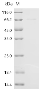 Recombinant Mouse Putative phospholipase B-like 2 (Plbd2)