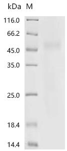 Recombinant Human Collagen alpha-1 (XVIII) chain (COL18A1), partial