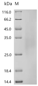 Recombinant Human Collagen alpha-1 (XVIII) chain (COL18A1), partial