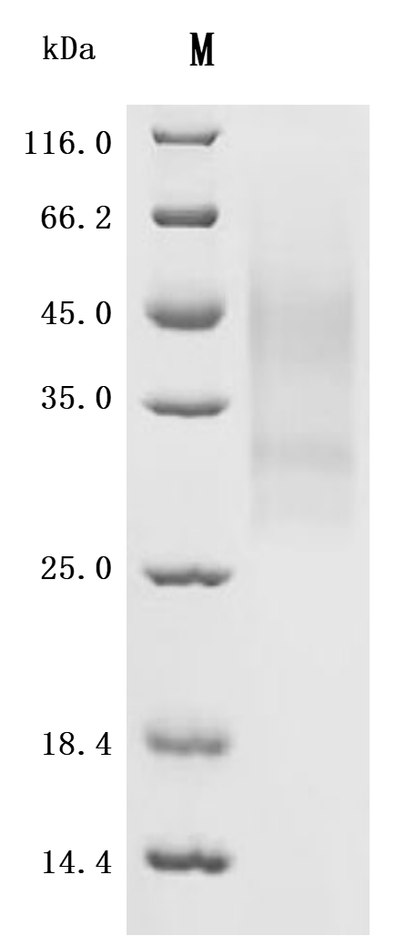 Recombinant Human Tumor necrosis factor receptor superfamily member 3 (LTBR), partial