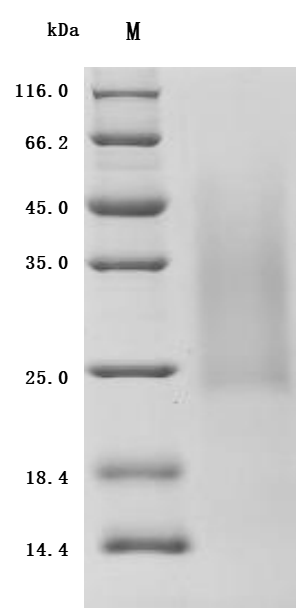 Recombinant Mouse Activin receptor type-2B (Acvr2b), partial (Active)