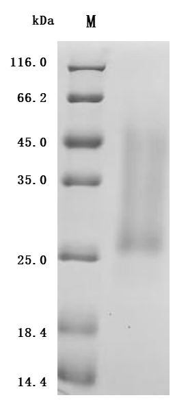 Recombinant Human/Cynomolgus monkey Activin receptor type-2A (ACVR2A), partial (Active)